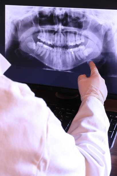 Best Emergency Root Canal Treatment in Alma, NE