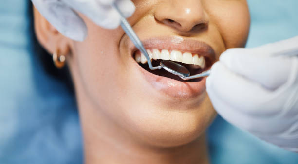 Best Emergency Dentist for Lost Fillings or Crowns in Alma, NE